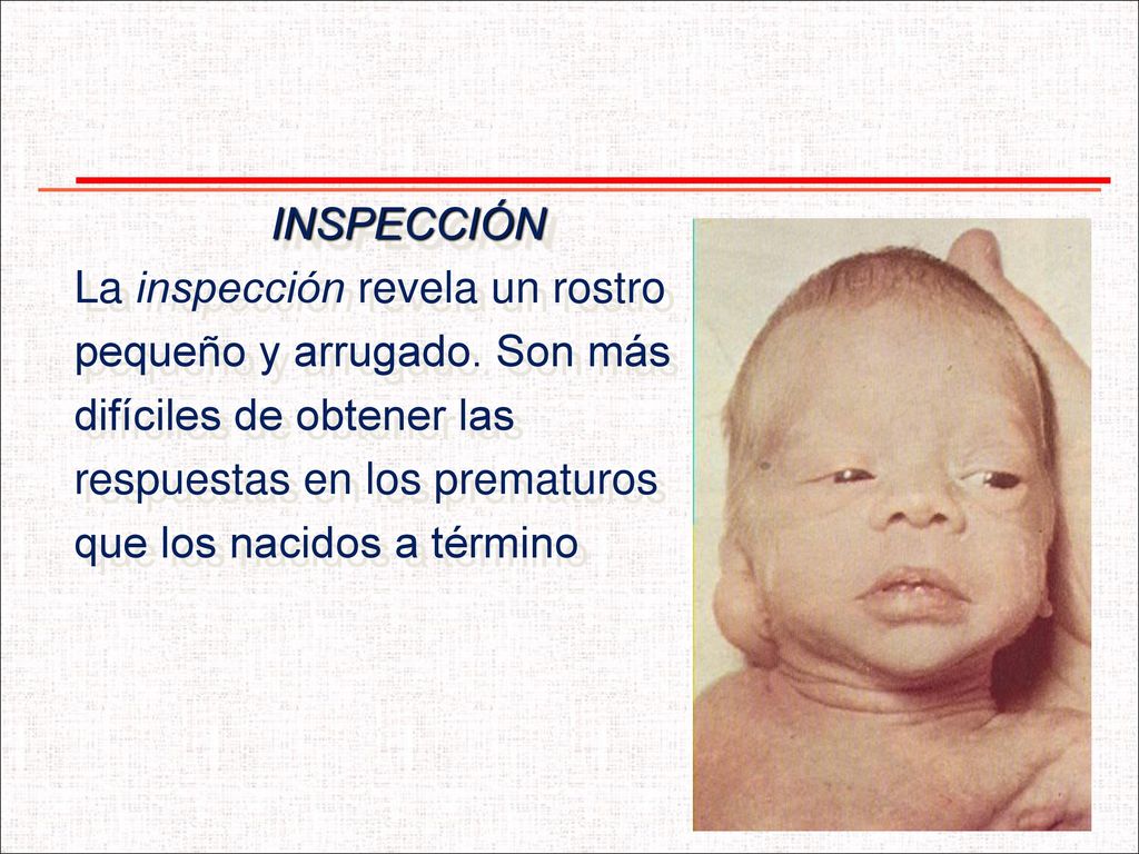 INSPECCIÓN La inspección revela un rostro. pequeño y arrugado. Son más. difíciles de obtener las.