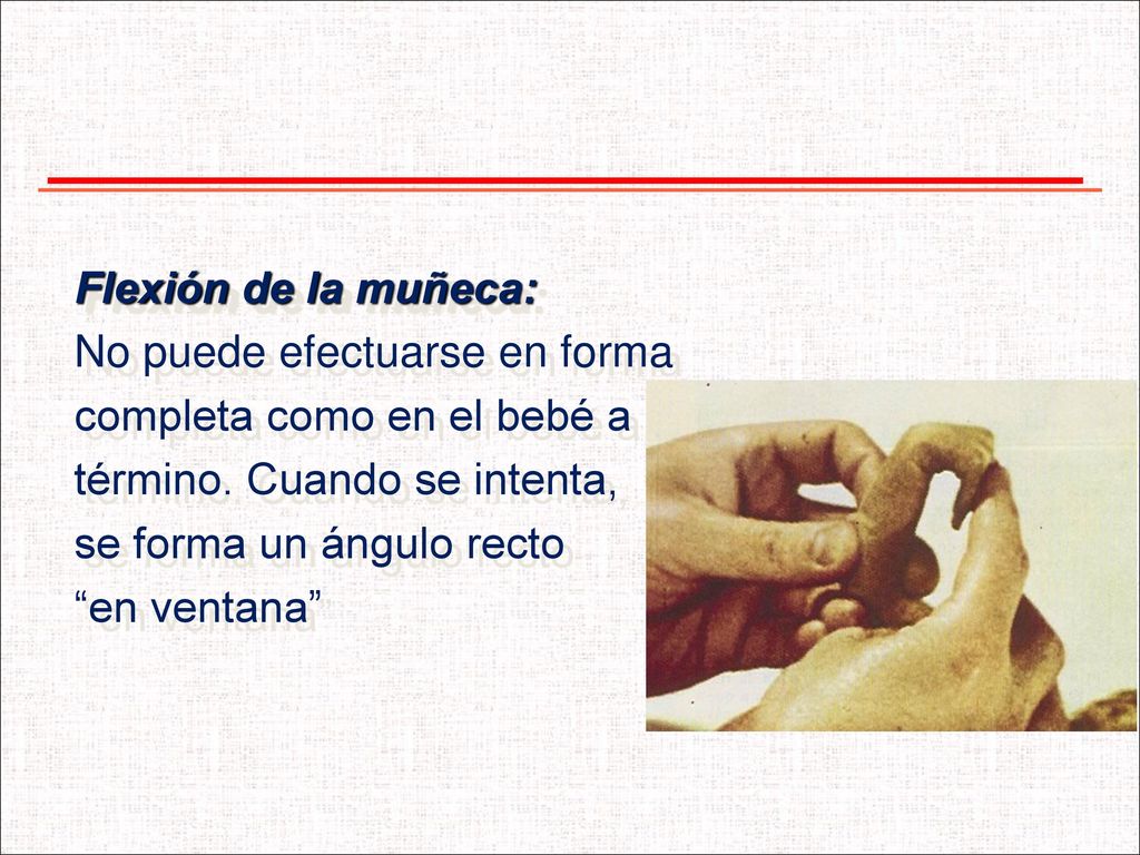 Flexión de la muñeca: No puede efectuarse en forma. completa como en el bebé a. término. Cuando se intenta,