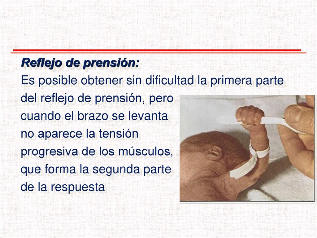 Reflejo de prensión: Es posible obtener sin dificultad la primera parte. del reflejo de prensión, pero.