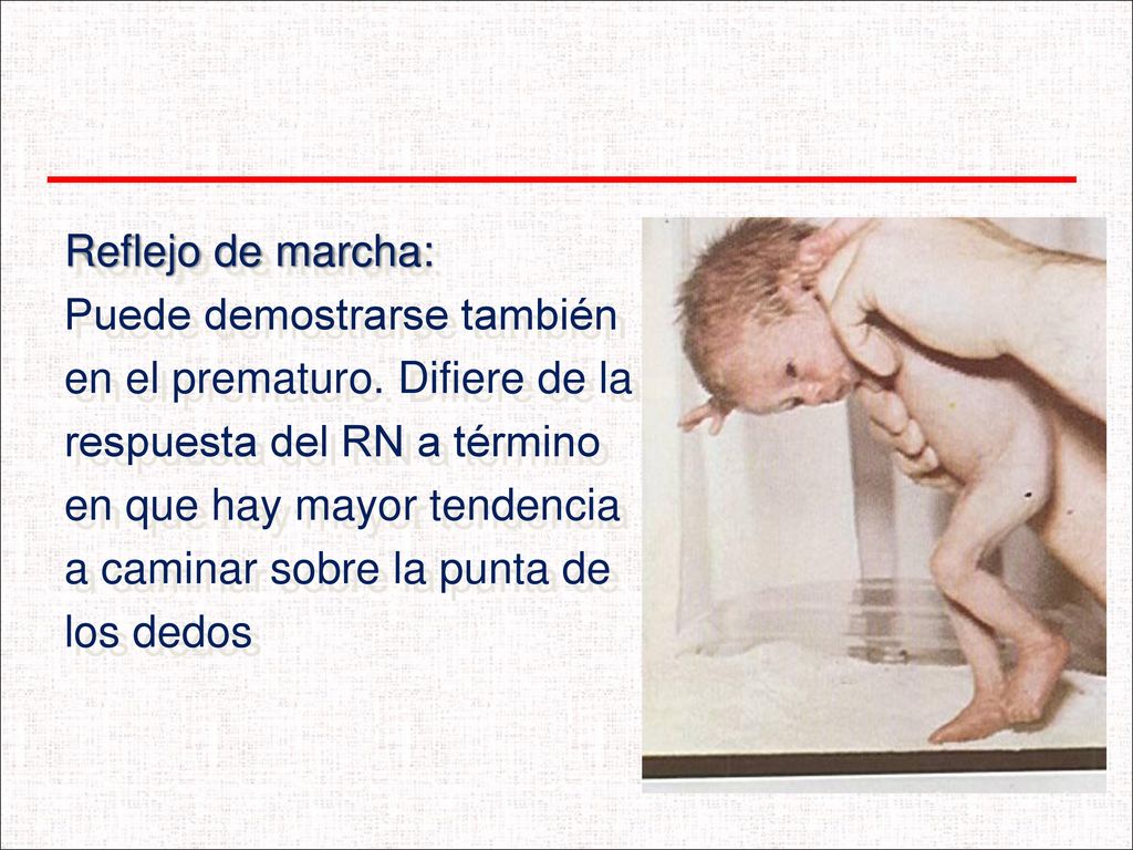 Reflejo de marcha: Puede demostrarse también. en el prematuro. Difiere de la. respuesta del RN a término.