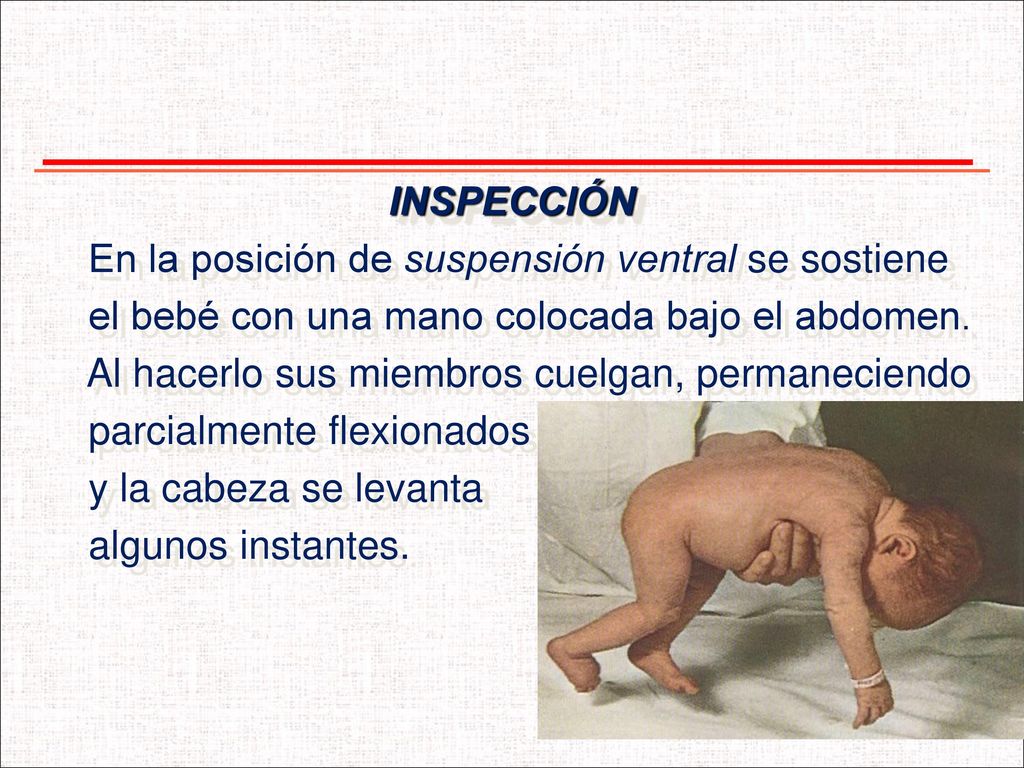 INSPECCIÓN En la posición de suspensión ventral se sostiene. el bebé con una mano colocada bajo el abdomen.