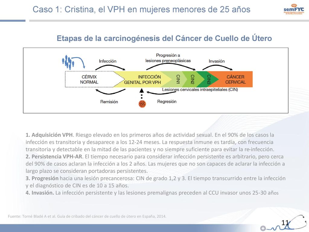 Etapas de la carcinogénesis del Cáncer de Cuello de Útero