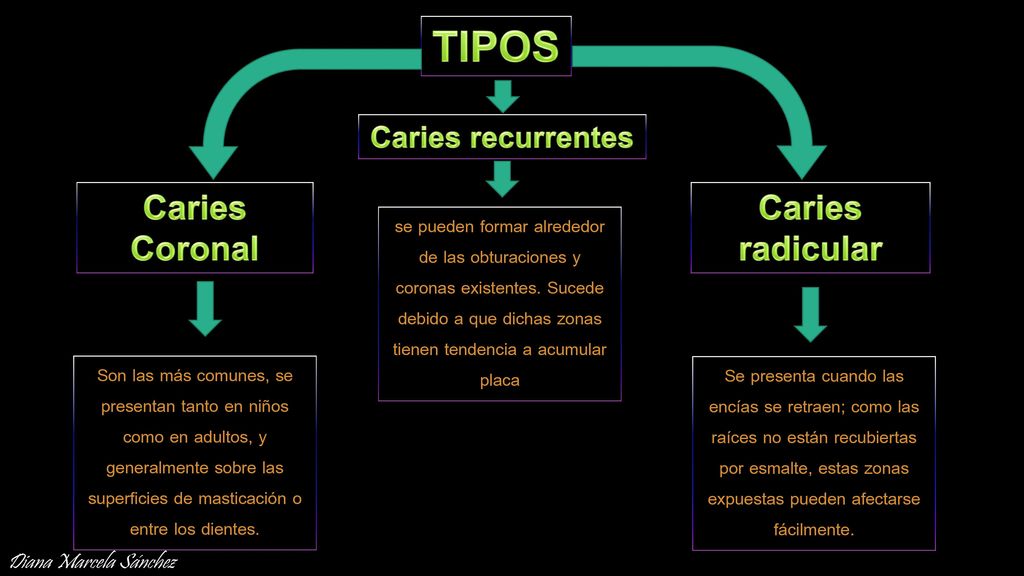 TIPOS Caries Coronal Caries radicular Caries recurrentes