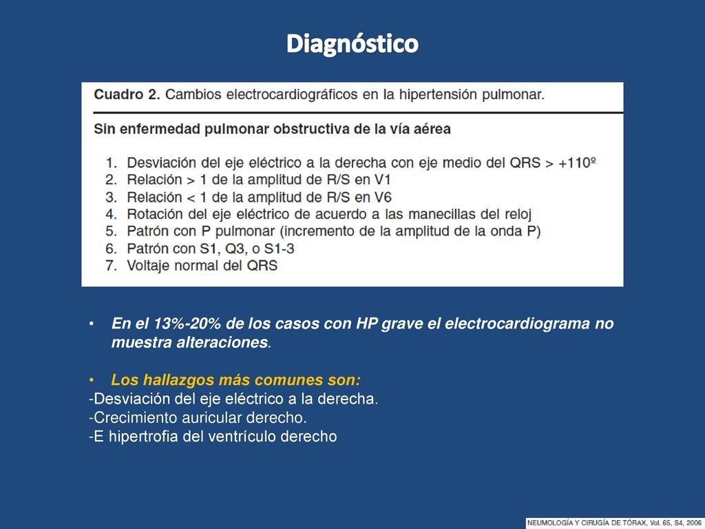 Diagnóstico En el 13%-20% de los casos con HP grave el electrocardiograma no muestra alteraciones. Los hallazgos más comunes son: