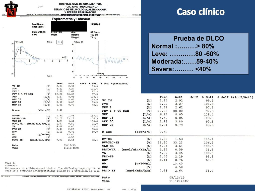 Caso clínico Prueba de DLCO Normal :………> 80% Leve: …………80 -60%