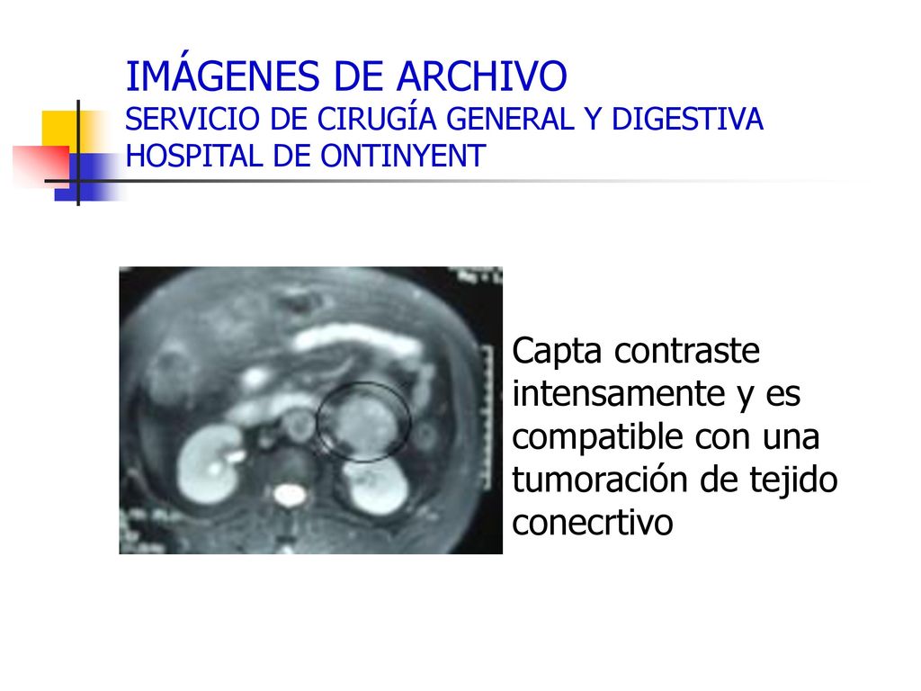 IMÁGENES DE ARCHIVO SERVICIO DE CIRUGÍA GENERAL Y DIGESTIVA HOSPITAL DE ONTINYENT