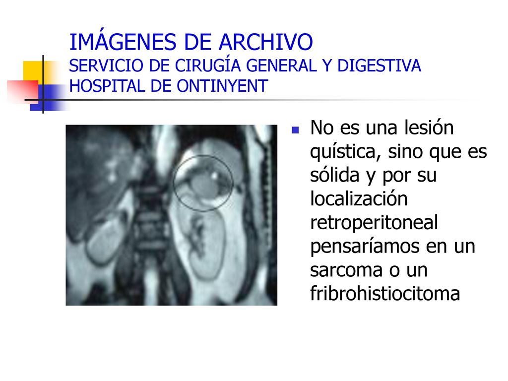 IMÁGENES DE ARCHIVO SERVICIO DE CIRUGÍA GENERAL Y DIGESTIVA HOSPITAL DE ONTINYENT