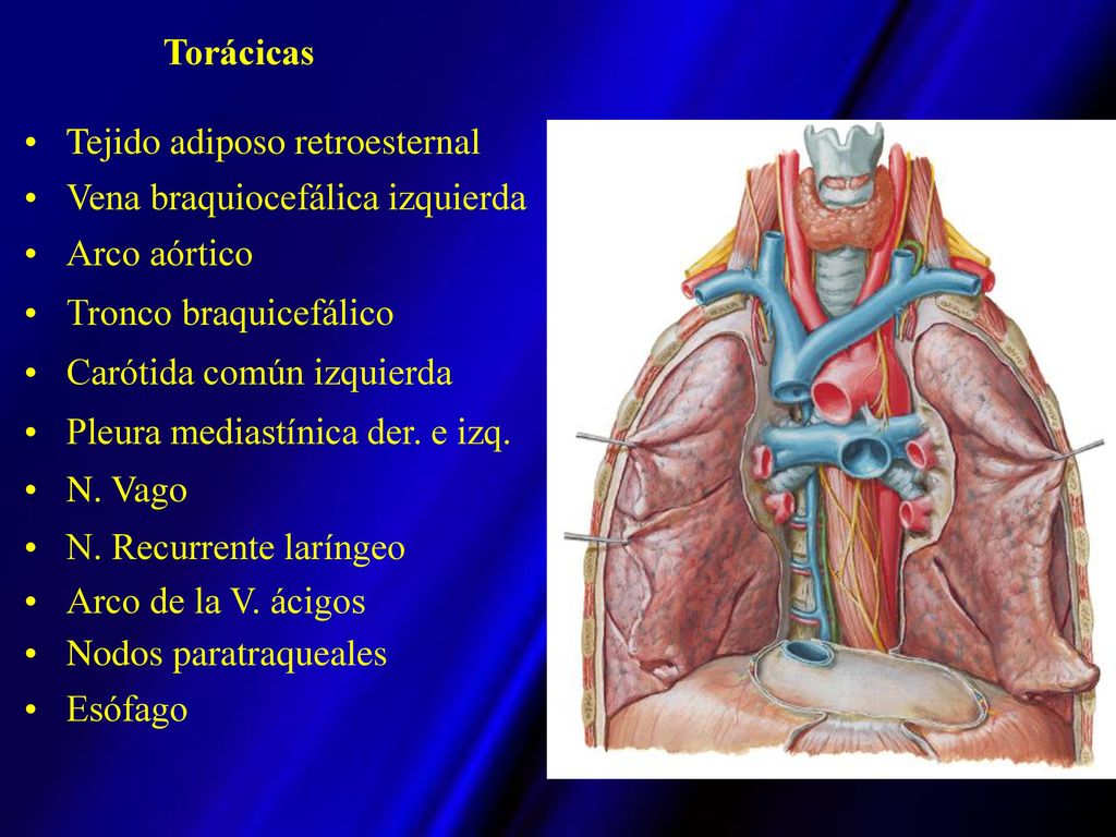 Torácicas Tejido adiposo retroesternal. Vena braquiocefálica izquierda. Arco aórtico. Tronco braquicefálico.