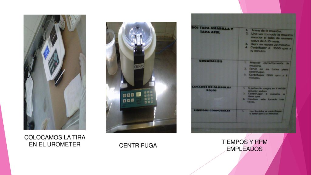 COLOCAMOS LA TIRA EN EL UROMETER TIEMPOS Y RPM EMPLEADOS CENTRIFUGA