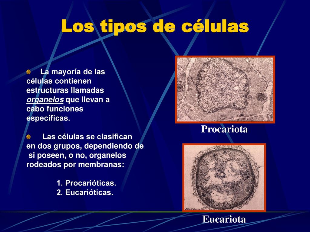 Los tipos de células Procariota Eucariota La mayoría de las