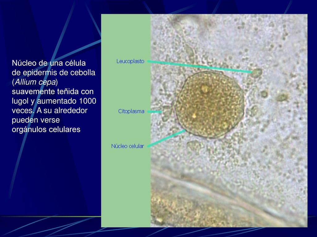 Núcleo de una célula de epidermis de cebolla (Allium cepa) suavemente teñida con lugol y aumentado 1000 veces.