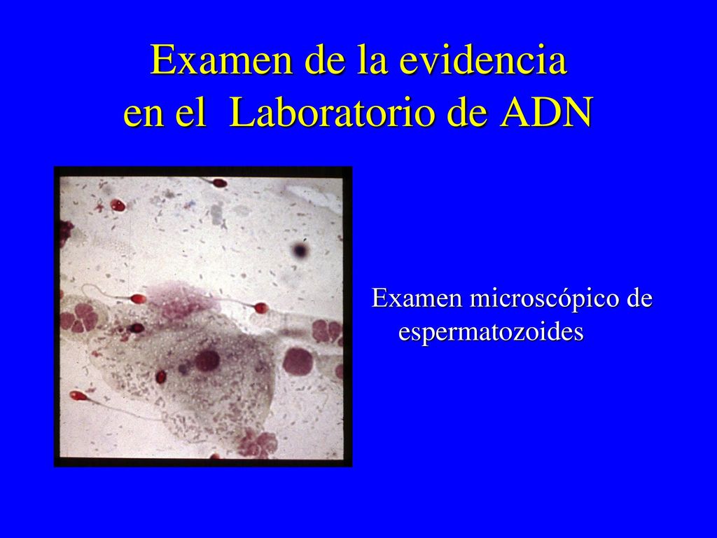 Examen de la evidencia en el Laboratorio de ADN