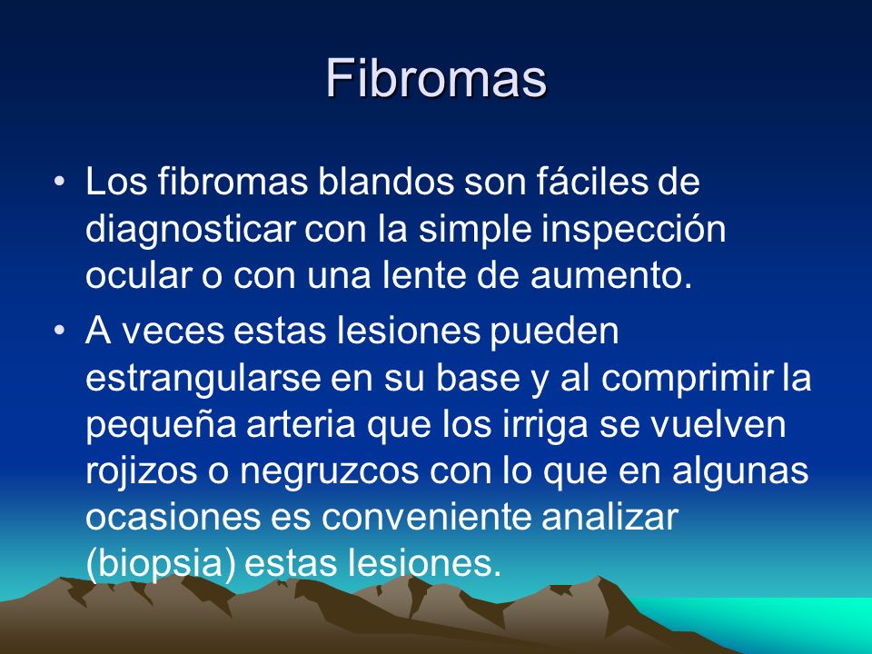 Fibromas Los fibromas blandos son fáciles de diagnosticar con la simple inspección ocular o con una lente de aumento.