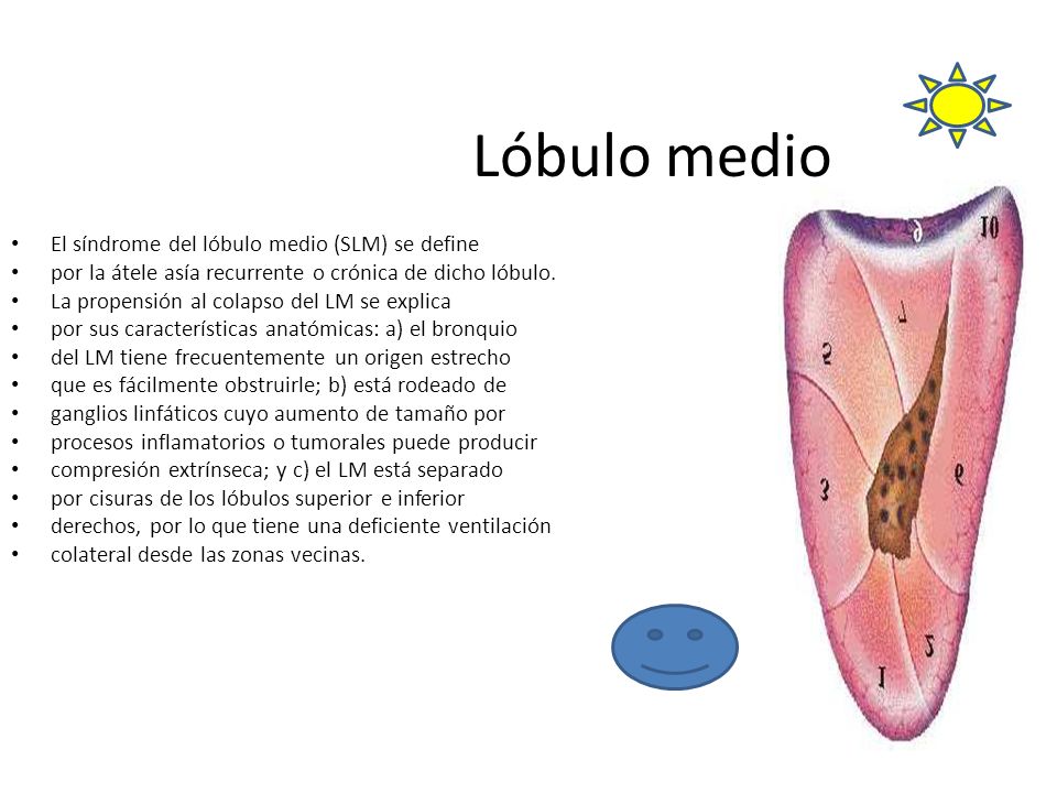 Lóbulo medio El síndrome del lóbulo medio (SLM) se define