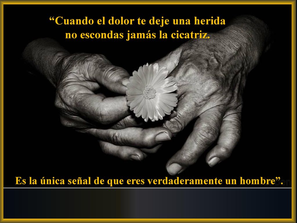 Cuando el dolor te deje una herida no escondas jamás la cicatriz.