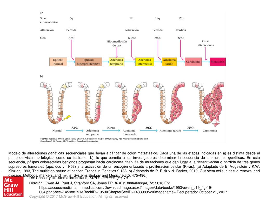 Modelo de alteraciones genéticas secuenciales que llevan a cáncer de colon metastásico. Cada una de las etapas indicadas en a) es distinta desde el punto de vista morfológico, como se ilustra en b), lo que permite a los investigadores determinar la secuencia de alteraciones genéticas. En esta secuencia, pólipos colorrectales benignos progresan hacia carcinoma después de mutaciones que dan lugar a la desactivación o pérdida de tres genes supresores tumorales (apc, dcc y TP53) y la activación de un oncogén enlazado a proliferación celular (K-ras). [a) Adaptado de B. Vogelstein y K.W. Kinzler, 1993, The multistep nature of cancer, Trends in Genetics 9:138. b) Adaptado de P. Rizk y N. Barker, 2012, Gut stem cells in tissue renewal and disease: Methods, markers, and myths, Systems Biology and Medicine 4:5, ]