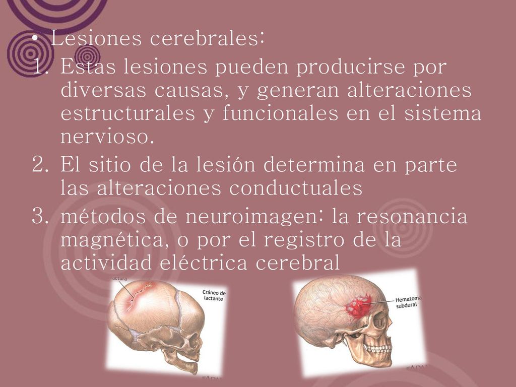 Lesiones cerebrales: Estas lesiones pueden producirse por diversas causas, y generan alteraciones estructurales y funcionales en el sistema nervioso.