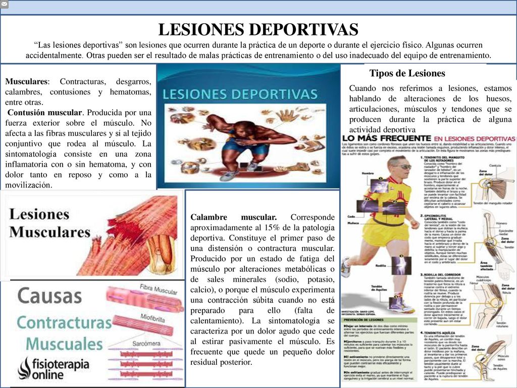 LESIONES DEPORTIVAS TTI Tipos de Lesiones
