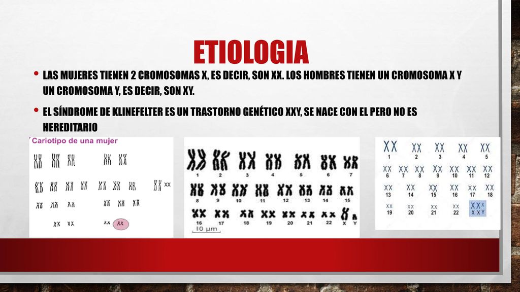 ETIOLOGIA Las mujeres tienen 2 cromosomas X, es decir, son XX. Los hombres tienen un cromosoma X y un cromosoma Y, es decir, son XY.