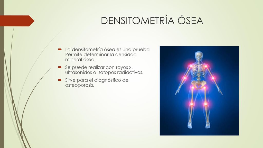 DENSITOMETRÍA ÓSEA La densitometría ósea es una prueba Permite determinar la densidad mineral ósea.