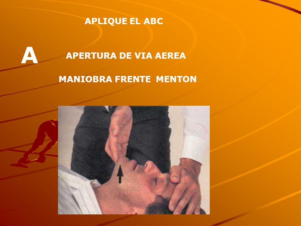 APLIQUE EL ABC A APERTURA DE VIA AEREA MANIOBRA FRENTE MENTON