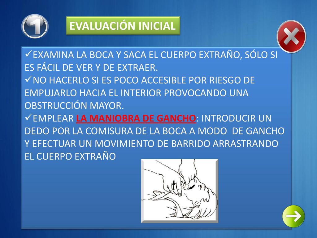 1 EVALUACIÓN INICIAL. EXAMINA LA BOCA Y SACA EL CUERPO EXTRAÑO, SÓLO SI ES FÁCIL DE VER Y DE EXTRAER.