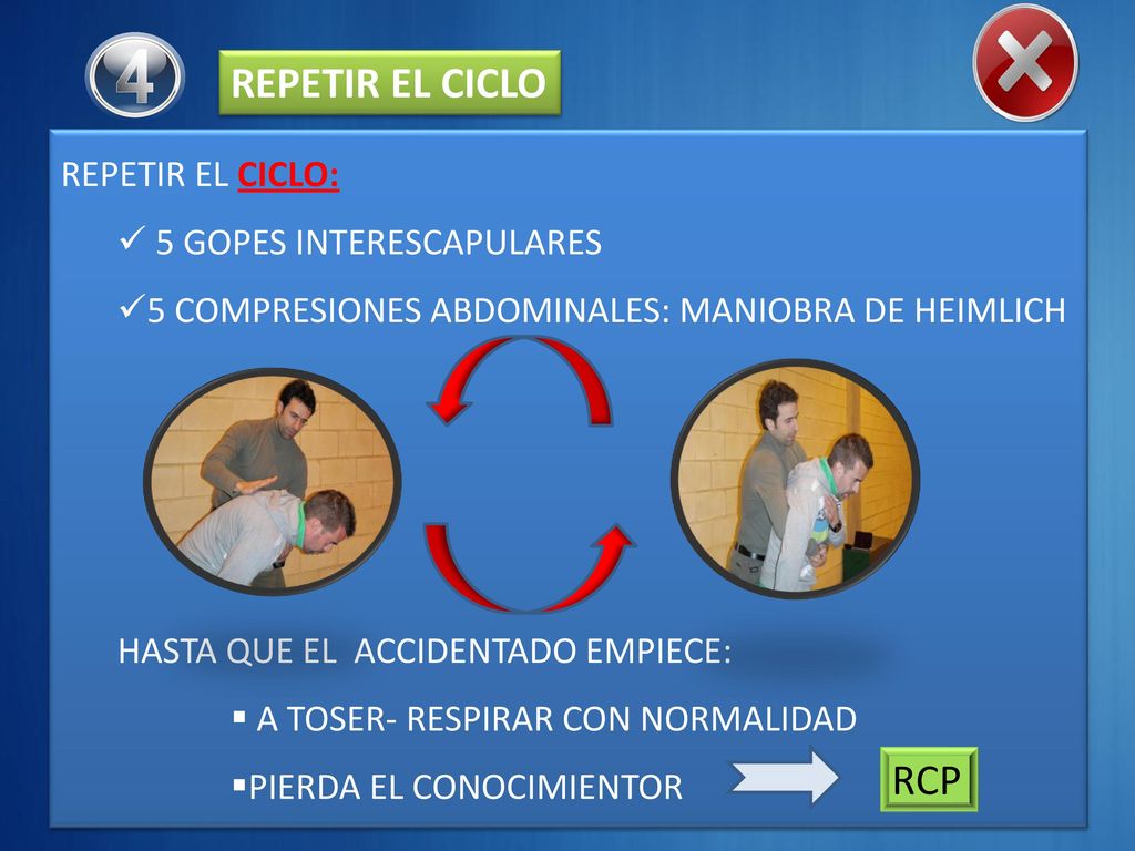 4 REPETIR EL CICLO RCP REPETIR EL CICLO: 5 GOPES INTERESCAPULARES