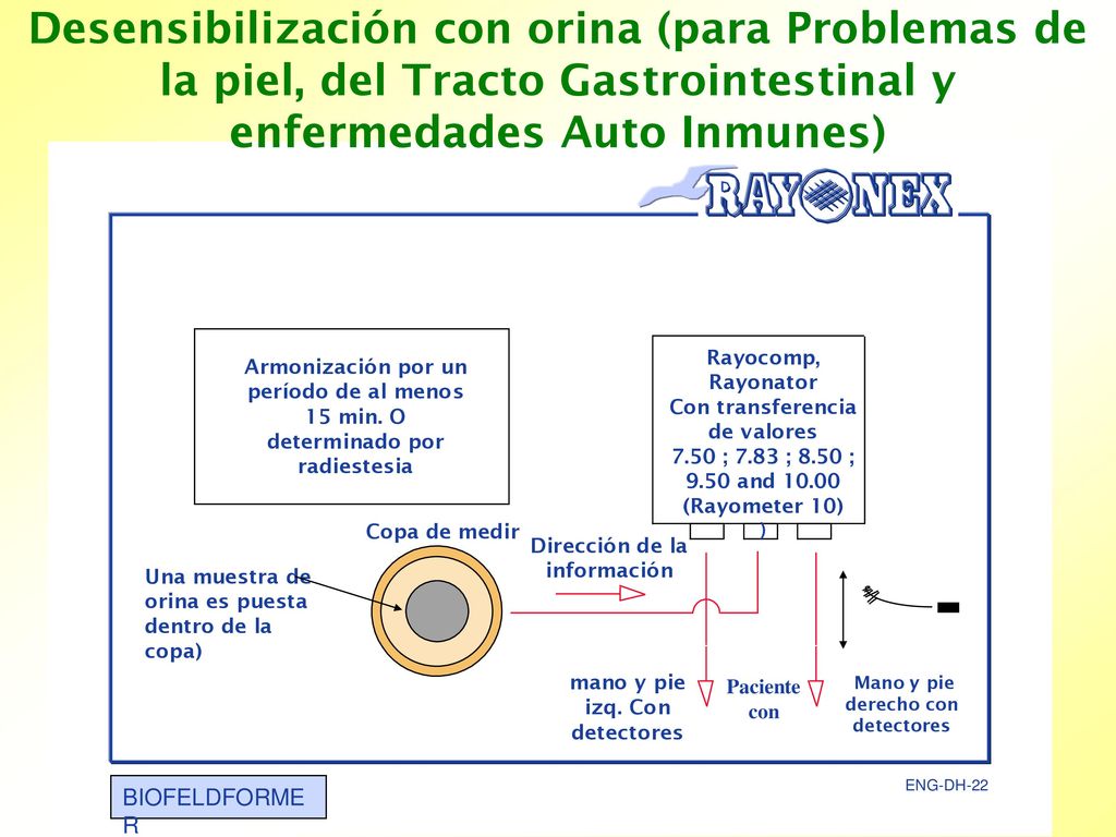 Desensibilización con orina (para Problemas de la piel, del Tracto Gastrointestinal y enfermedades Auto Inmunes)