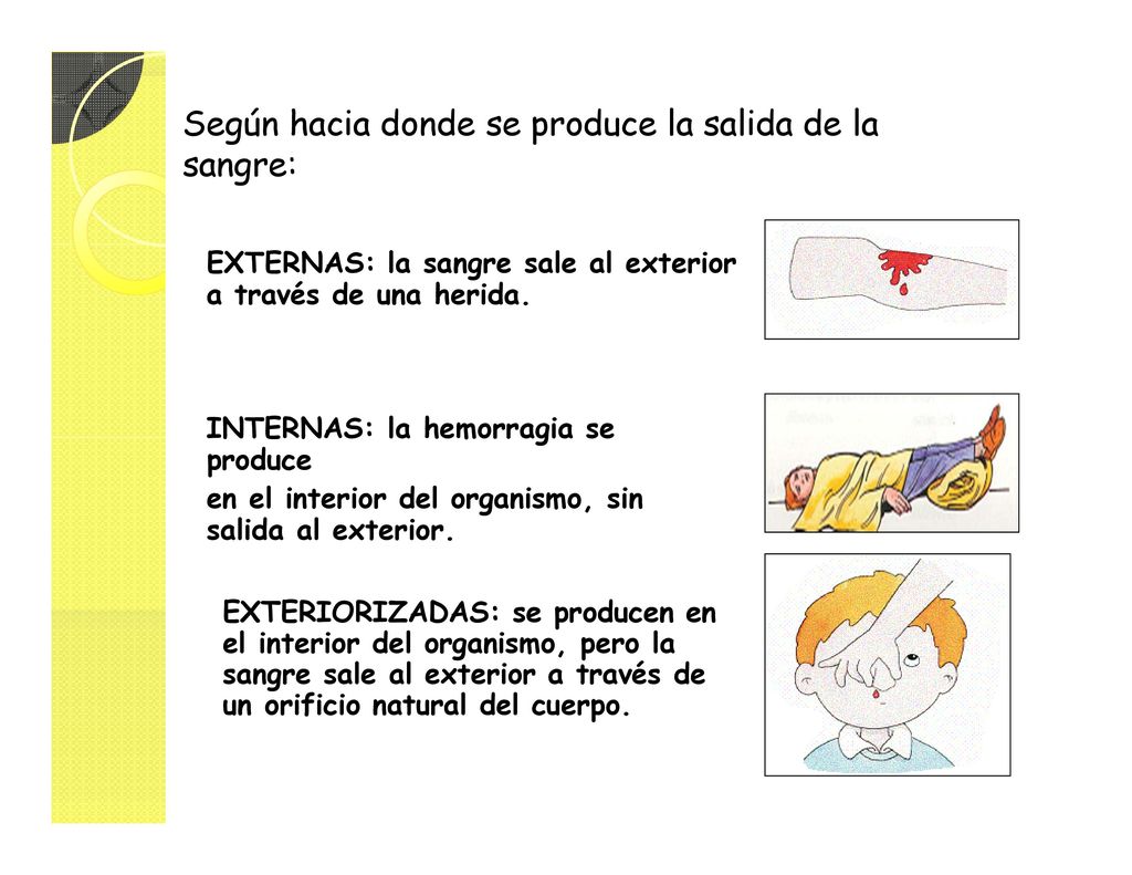 Según hacia donde se produce la salida de la sangre: