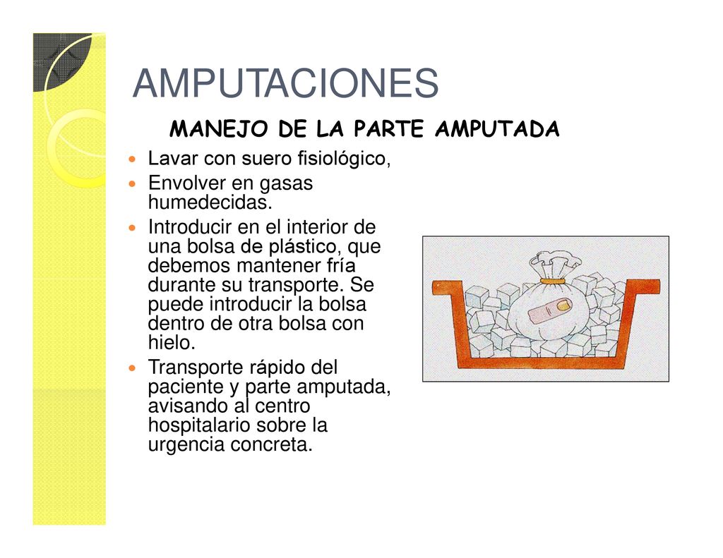 AMPUTACIONES MANEJO DE LA PARTE AMPUTADA Lavar con suero fisiológico,