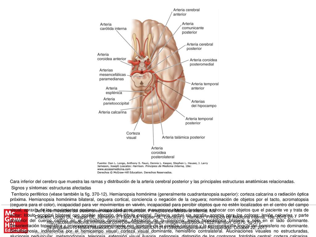Territorio central. Síndrome talámico: pérdida de sensibilidad (todas las modalidades), dolor y disestesias espontáneos, coreoatetosis, temblor intencional, espasmos de la mano, hemiparesia leve: núcleo posteroventral del tálamo; afección del núcleo subtalámico adyacente o de sus vías aferentes. Síndrome talamoperforante: ataxia cerebelosa cruzada con parálisis ipsolateral del III par (síndrome de Claude): haz dentotalámico y III par correspondiente. Síndrome de Weber: parálisis del tercer par y hemiplejía contralateral: III par craneal y pedúnculo cerebral. Hemiplejía contralateral: pedúnculo cerebral. Parálisis o paresia de los movimientos oculares verticales, desviación oblicua, respuestas pupilares lentas a la luz, miosis y ptosis leves (se puede asociar nistagmo de retracción y cansancio de los párpados): fibras supranucleares para el III par, núcleo intersticial de Cajal, núcleo de Darkschewitsch y comisura posterior. Temblor contralateral rítmico, atáxico y de acción; temblor rítmico postural o de mantenimiento (temblor rúbrico): haz dentotalámico.