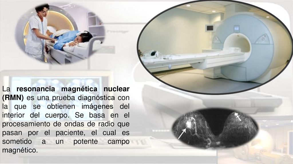 La resonancia magnética nuclear (RMN) es una prueba diagnóstica con la que se obtienen imágenes del interior del cuerpo.