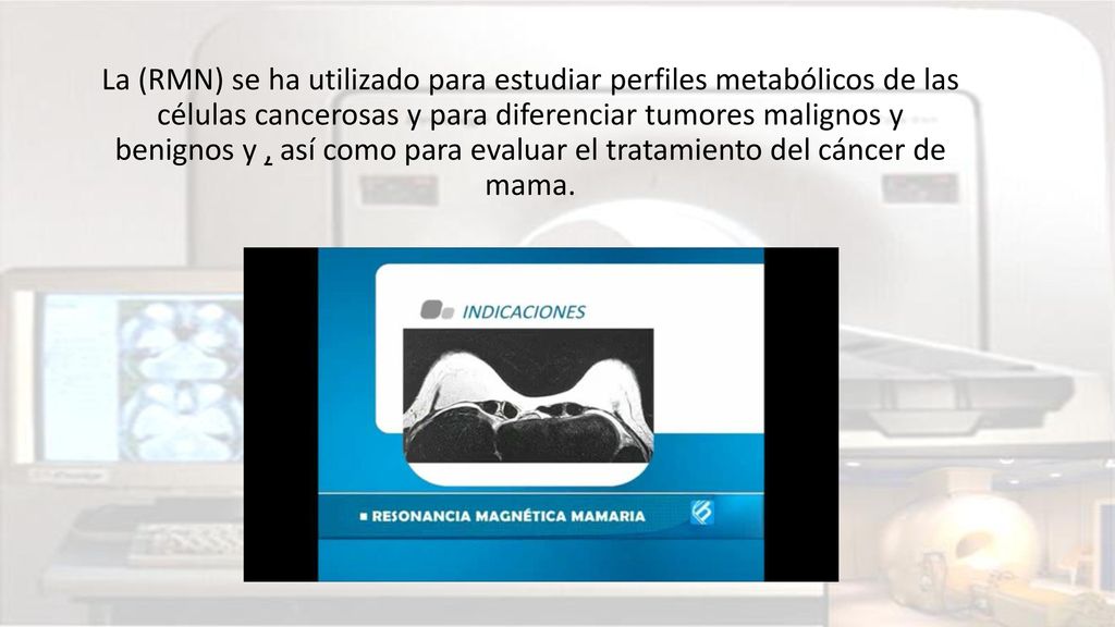 La (RMN) se ha utilizado para estudiar perfiles metabólicos de las células cancerosas y para diferenciar tumores malignos y benignos y , así como para evaluar el tratamiento del cáncer de mama.