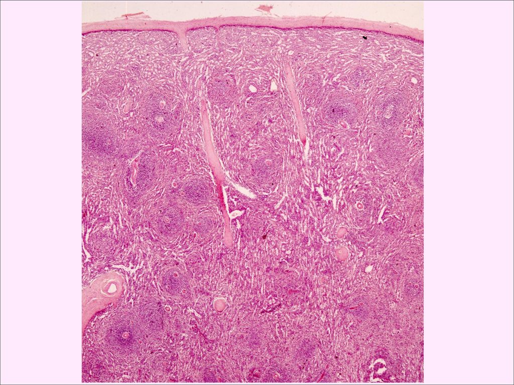 vena trabecular pulpa blanca. arteria trabecular. zona marginal. folículo linfoide. centro germinal.
