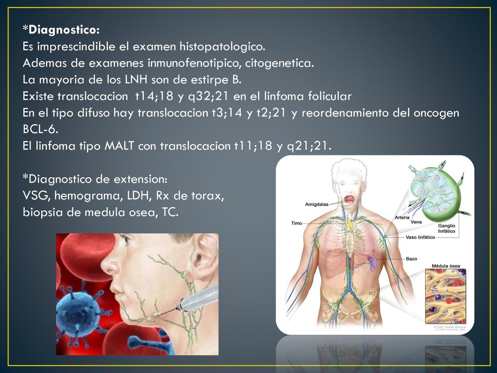 *Diagnostico: Es imprescindible el examen histopatologico. Ademas de examenes inmunofenotipico, citogenetica.