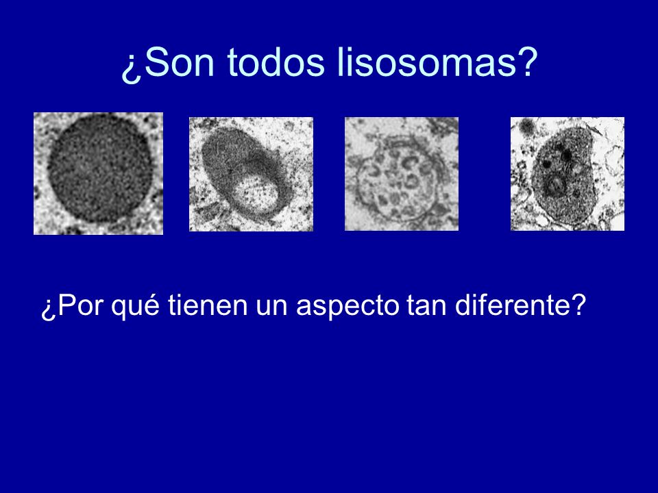 ¿Son todos lisosomas ¿Por qué tienen un aspecto tan diferente