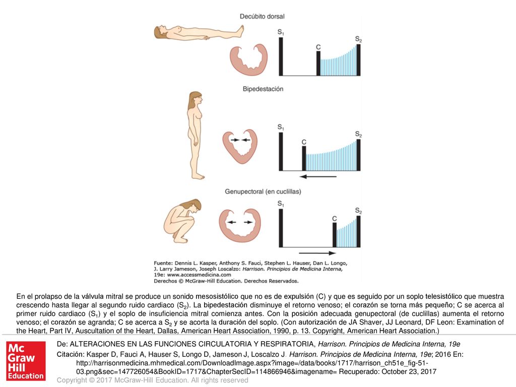 En el prolapso de la válvula mitral se produce un sonido mesosistólico que no es de expulsión (C) y que es seguido por un soplo telesistólico que muestra crescendo hasta llegar al segundo ruido cardiaco (S2). La bipedestación disminuye el retorno venoso; el corazón se torna más pequeño; C se acerca al primer ruido cardiaco (S1) y el soplo de insuficiencia mitral comienza antes. Con la posición adecuada genupectoral (de cuclillas) aumenta el retorno venoso; el corazón se agranda; C se acerca a S2 y se acorta la duración del soplo. (Con autorización de JA Shaver, JJ Leonard, DF Leon: Examination of the Heart, Part IV, Auscultation of the Heart, Dallas, American Heart Association, 1990, p. 13. Copyright, American Heart Association.)