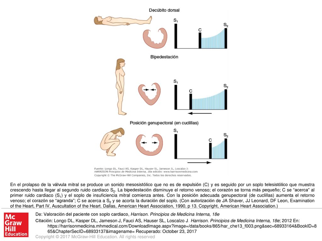 En el prolapso de la válvula mitral se produce un sonido mesosistólico que no es de expulsión (C) y es seguido por un soplo telesistólico que muestra crescendo hasta llegar al segundo ruido cardiaco S2. La bipedestación disminuye el retorno venoso; el corazón se torna más pequeño; C se acerca al primer ruido cardiaco (S1) y el soplo de insuficiencia mitral comienza antes. Con la posición adecuada genupectoral (de cuclillas) aumenta el retorno venoso; el corazón se agranda ; C se acerca a S2 y se acorta la duración del soplo. (Con autorización de JA Shaver, JJ Leonard, DF Leon, Examination of the Heart, Part IV, Auscultation of the Heart. Dallas, American Heart Association, 1990, p 13. Copyright, American Heart Association.)