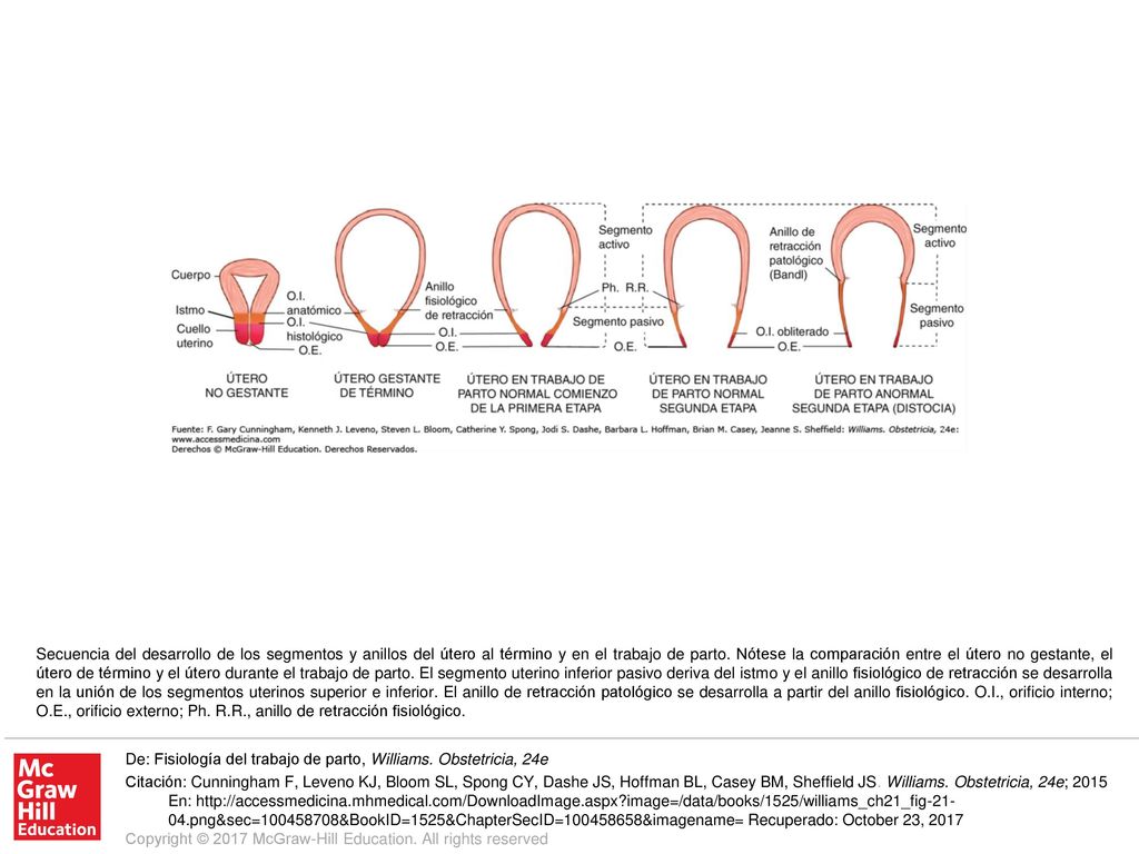 Secuencia del desarrollo de los segmentos y anillos del útero al término y en el trabajo de parto. Nótese la comparación entre el útero no gestante, el útero de término y el útero durante el trabajo de parto. El segmento uterino inferior pasivo deriva del istmo y el anillo fisiológico de retracción se desarrolla en la unión de los segmentos uterinos superior e inferior. El anillo de retracción patológico se desarrolla a partir del anillo fisiológico. O.I., orificio interno; O.E., orificio externo; Ph. R.R., anillo de retracción fisiológico.