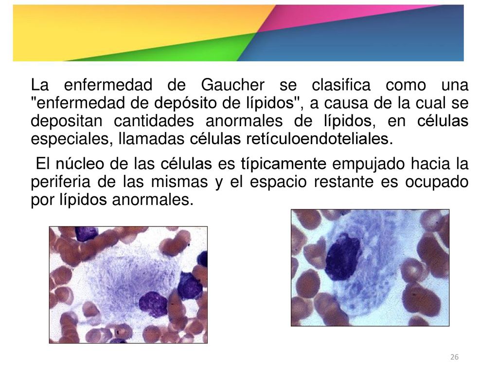 La enfermedad de Gaucher se clasifica como una enfermedad de depósito de lípidos , a causa de la cual se depositan cantidades anormales de lípidos, en células especiales, llamadas células retículoendoteliales.