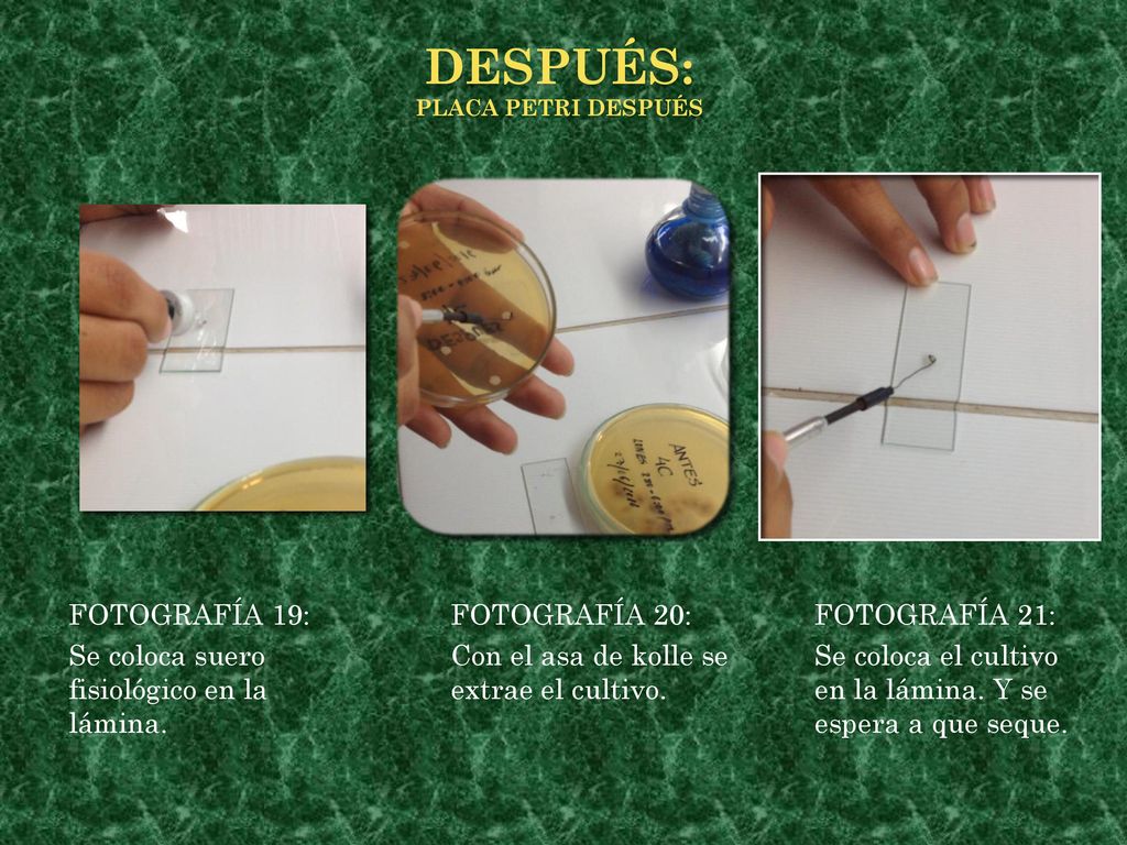 después: FOTOGRAFÍA 19: Se coloca suero fisiológico en la lámina.