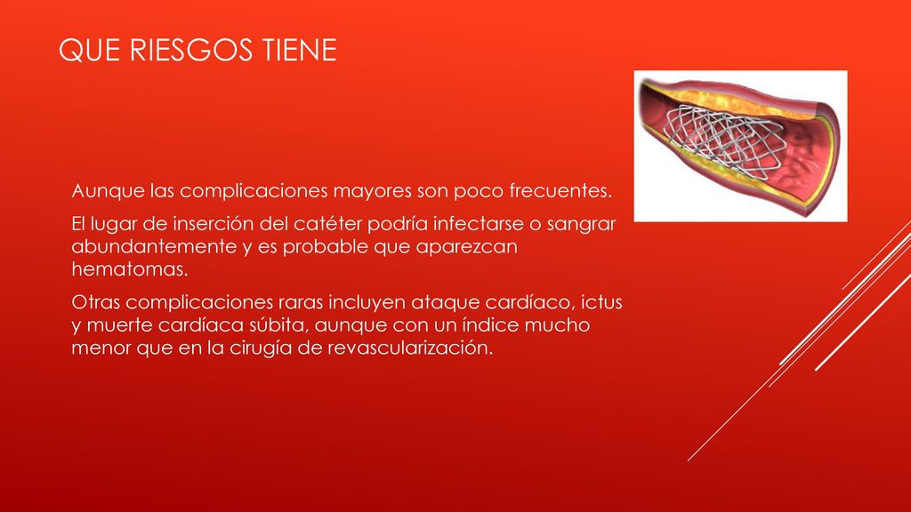 Que riesgos tiene Aunque las complicaciones mayores son poco frecuentes.