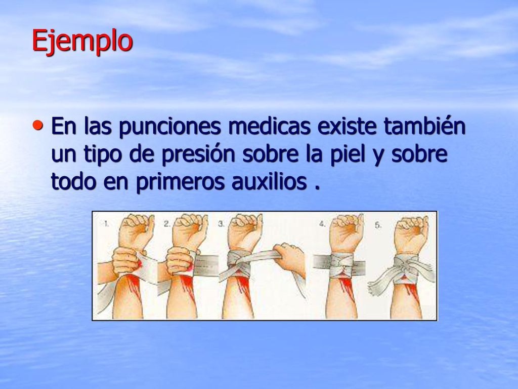 Ejemplo En las punciones medicas existe también un tipo de presión sobre la piel y sobre todo en primeros auxilios .