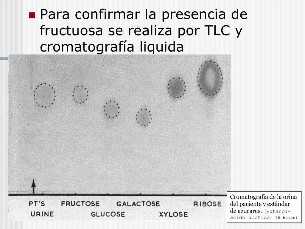 Para confirmar la presencia de fructuosa se realiza por TLC y cromatografía liquida