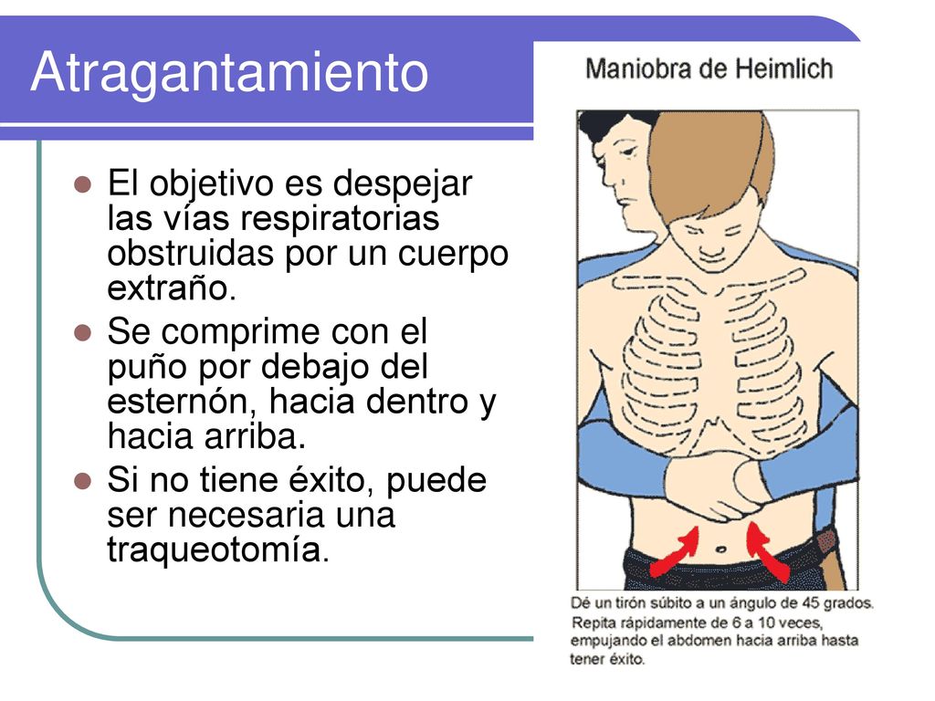 Atragantamiento El objetivo es despejar las vías respiratorias obstruidas por un cuerpo extraño.