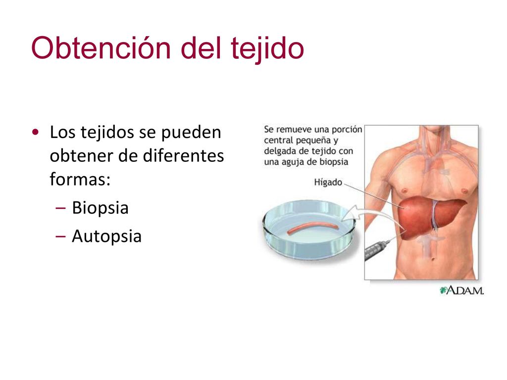Obtención del tejido Los tejidos se pueden obtener de diferentes formas: Biopsia Autopsia