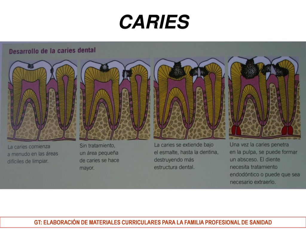 CARIES GT: ELABORACIÓN DE MATERIALES CURRICULARES PARA LA FAMILIA PROFESIONAL DE SANIDAD