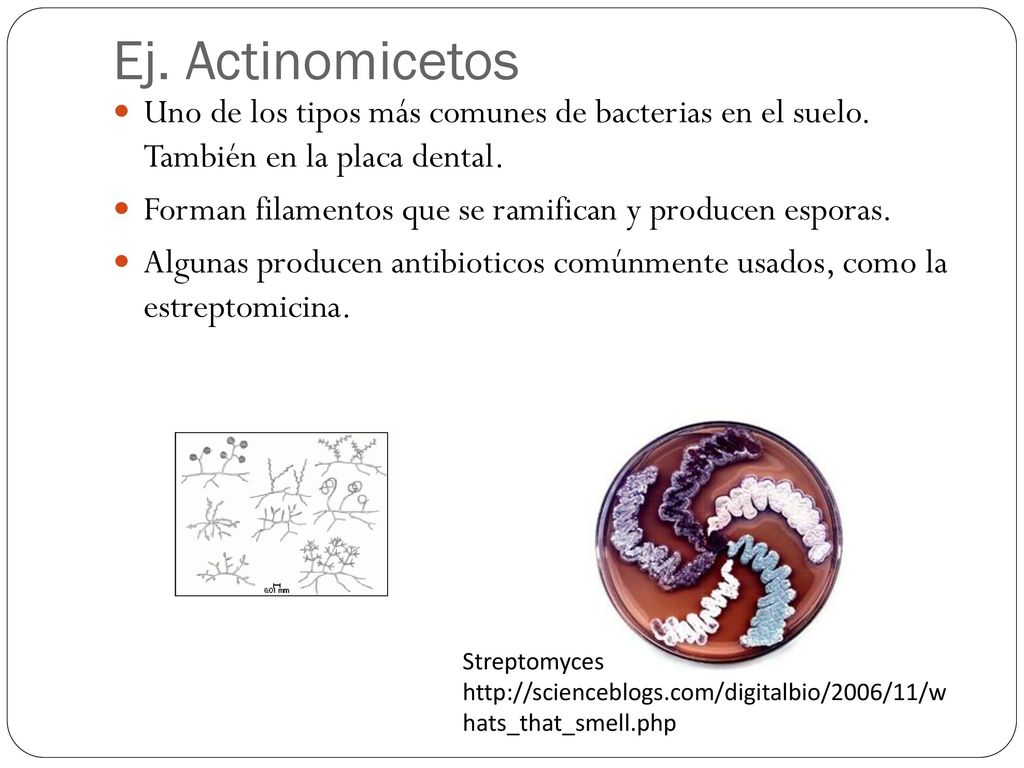 Ej. Actinomicetos Uno de los tipos más comunes de bacterias en el suelo. También en la placa dental.