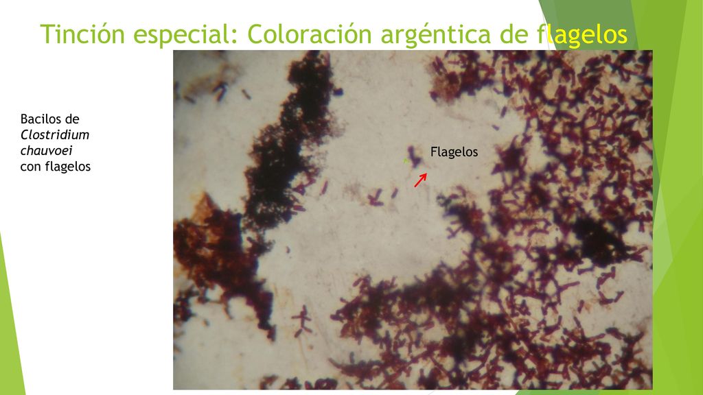 Tinción especial: Coloración argéntica de flagelos