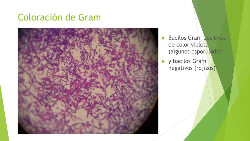 Coloración de Gram Bacilos Gram positivos de color violeta (algunos esporulados) y bacilos Gram negativos (rojizos)